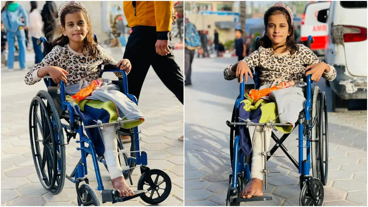 فقدت ساقها بقصف غزة.. الطفلة قمر: لن يُجهضوا حلمي بأن أصبح طبيبة أطفال

