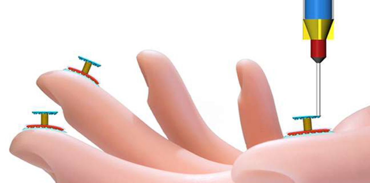 بالفيديو.. جلد إلكتروني يمكن طباعته على البشر ومنح الروبوتات حاسة اللمس