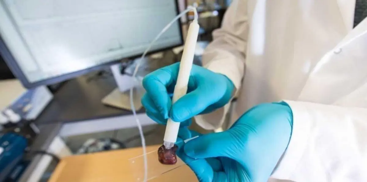 "قلم ماسبيك".. أداة تشخّص السرطان في 10 ثوان