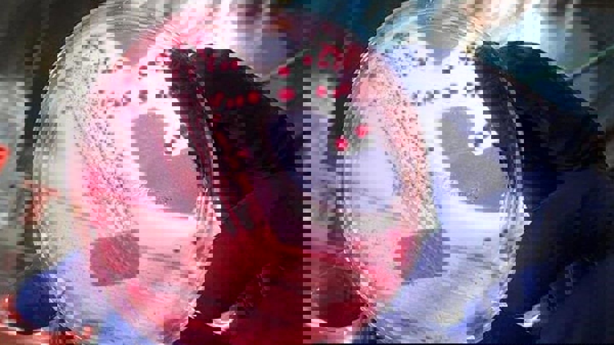 بعد دهوك.. الموصل تسجل أول إصابة بـ"الجمرة الخبيثة"