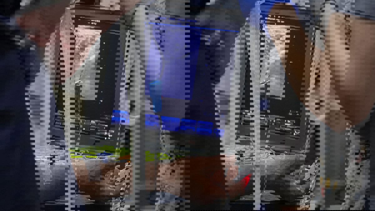 إصابة رئيس بلدية عينته موسكو لبلدة أوكرانية في هجوم