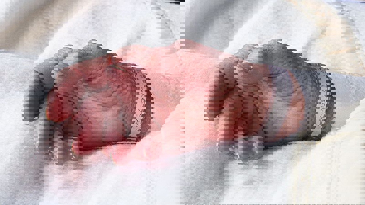 دراستان طبيتان تكشفان وجود تشابه بين "كورونا" و"سارس" 