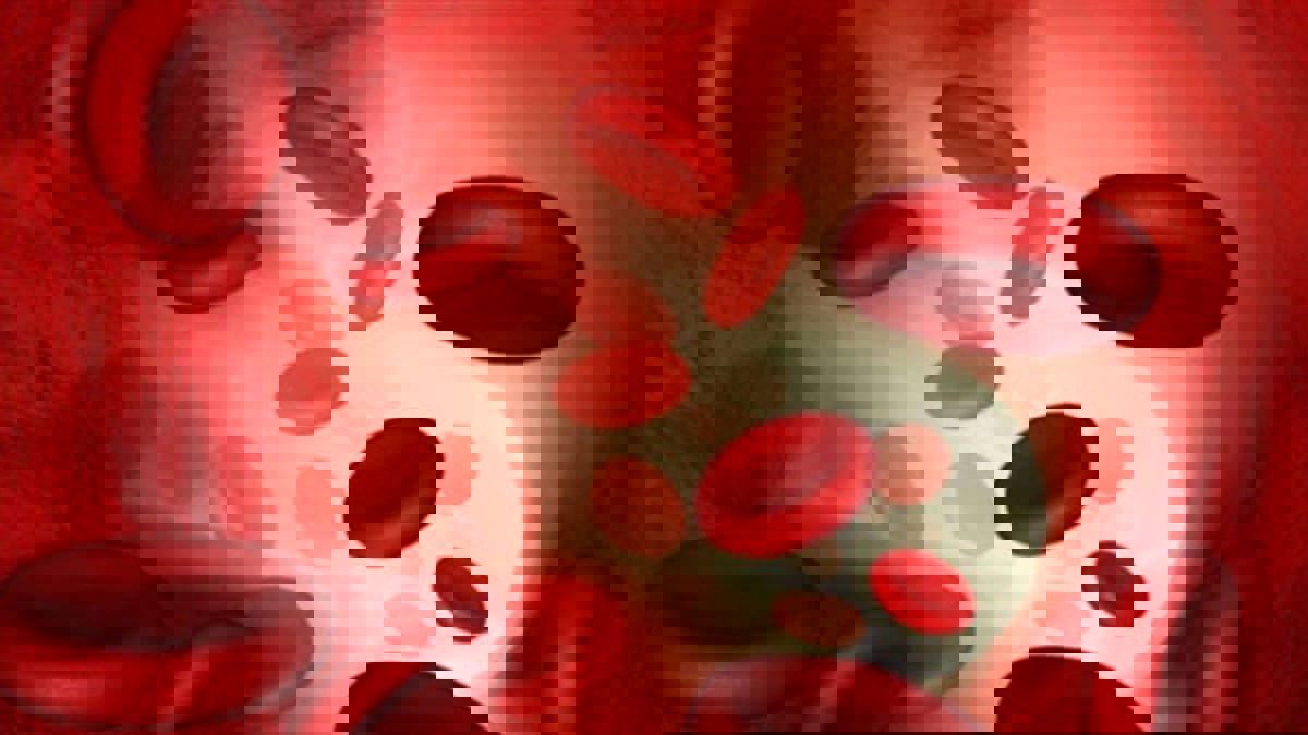 دراسة: نقص الحديد في الدم قد يسبب جلطة دماغية