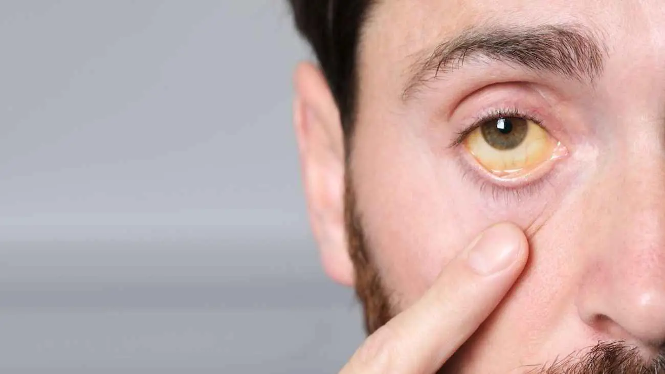 "مركّب اليرقان".. سلاح طبيعي ضد الملاريا