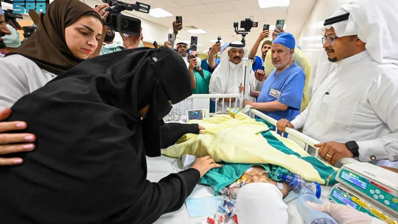 السعودية.. نجاح جراحة دقيقة لفصل التوأم الملتصق يارا ولارا (صور)