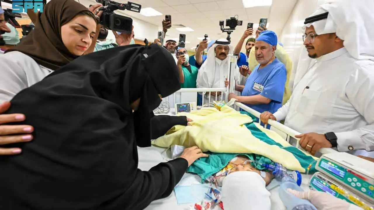 السعودية.. نجاح جراحة دقيقة لفصل التوأم الملتصق يارا ولارا (صور)