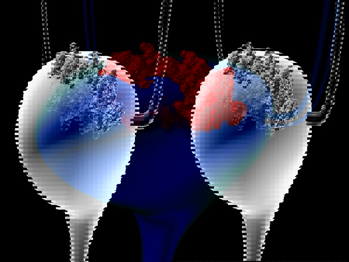 اكتشاف قد يحدث ثورة في علاج سرطان المثانة