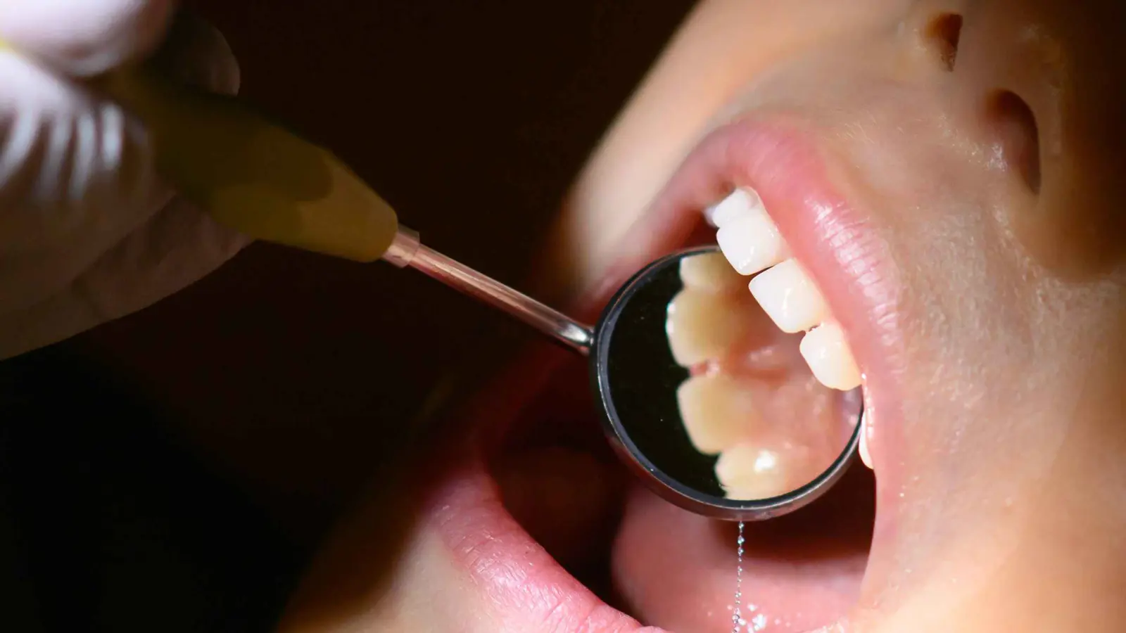 طبيب أسنان يثير الجدل بعلاج المرضى في شوارع دمشق (فيديو)