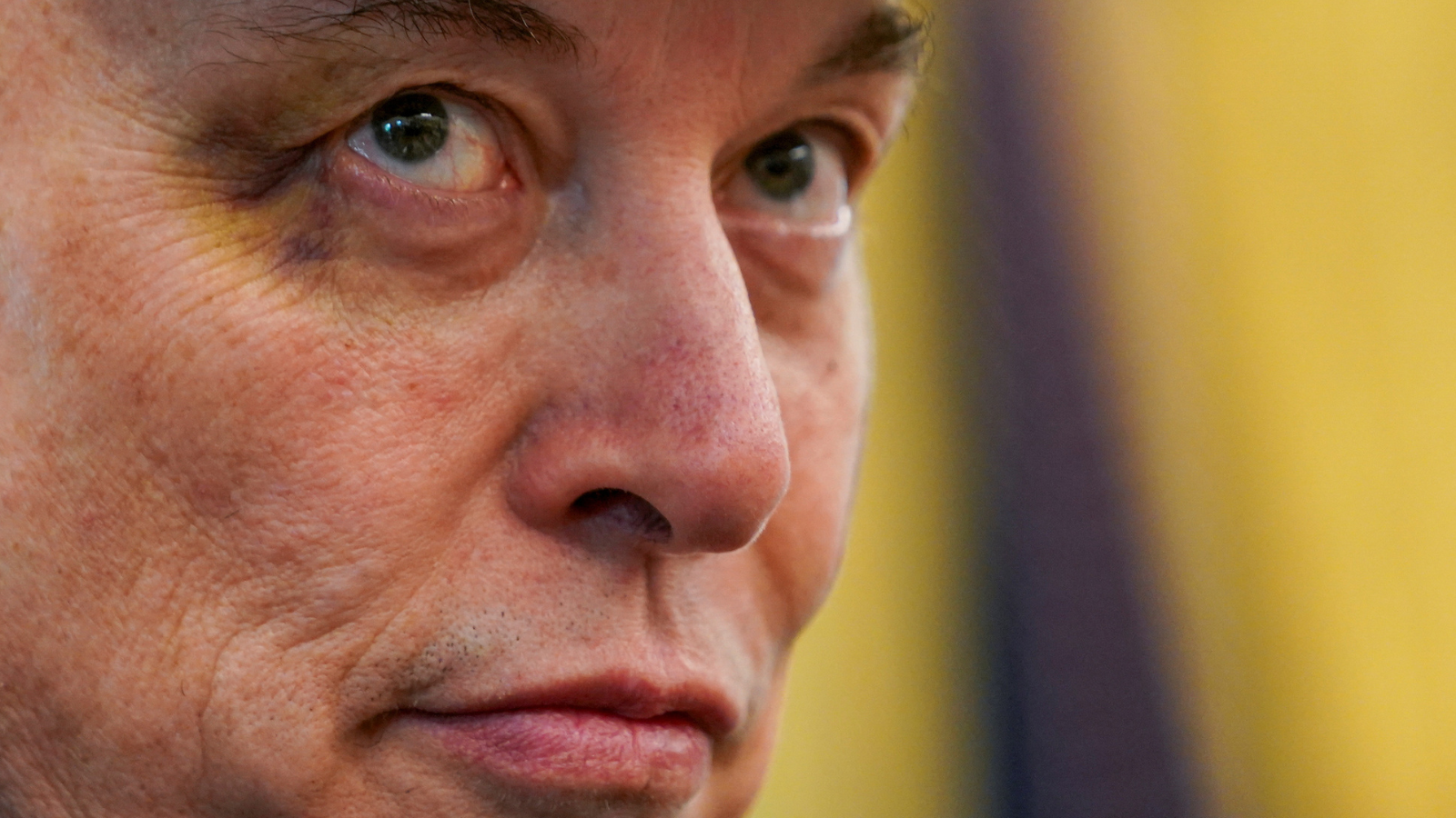 لكمة تورّم عين إيلون ماسك.. من المعتدي؟ (صور)