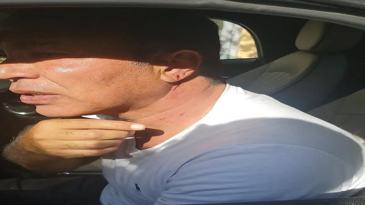 الاعتداء على أيمن يونس رئيس لجنة الكرة بالزمالك (صور)‎