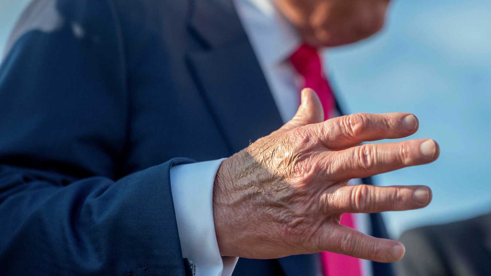 البيت الأبيض يكشف تفاصيل الحالة الصحية لترامب