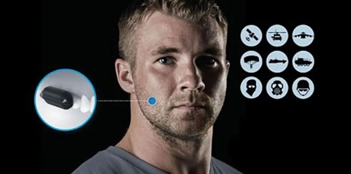 الجيش الأمريكي يكشف عن أجهزة اتصال يمكن زراعتها في أسنان الجنود (صور)