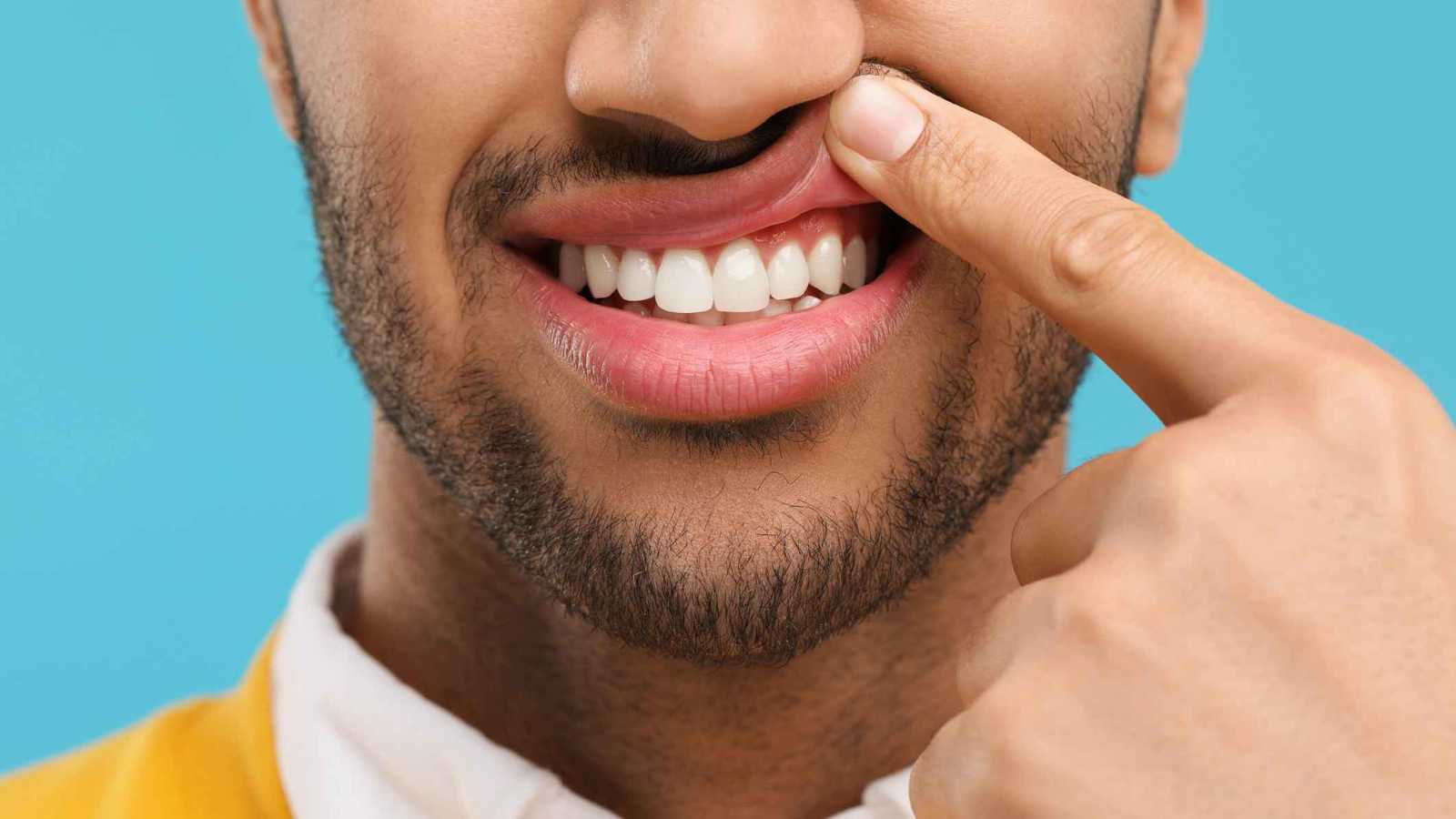 "اللثة المريضة" بوابة للاكتئاب وأمراض القلب