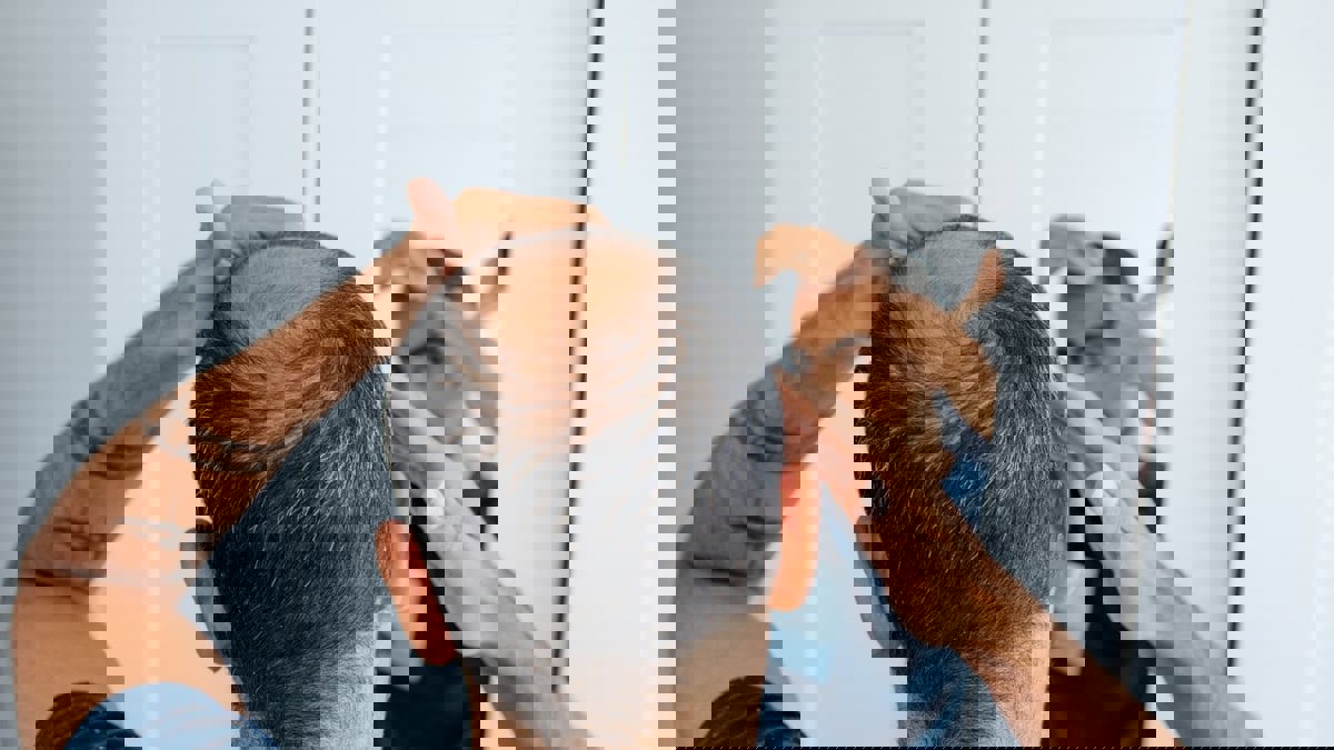 أفضل العلاجات الفعالة لتساقط الشعر عند الرجال