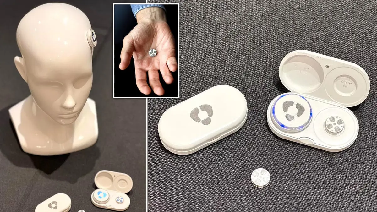 الكشف عن أول غرسة رقمية دماغية لعلاج الاكتئاب