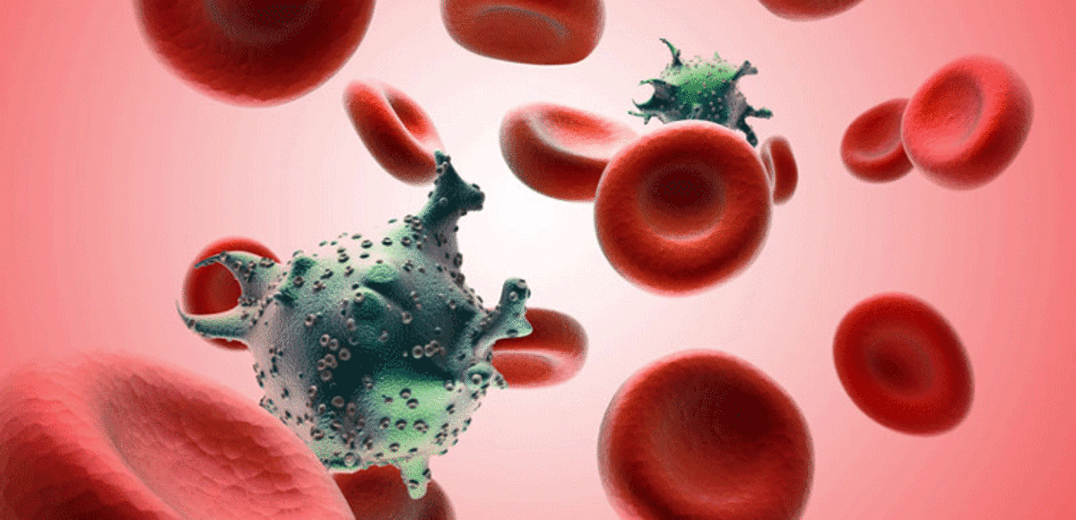 المدينة التي ظهر فيها مرض الإيدز لأول مرة