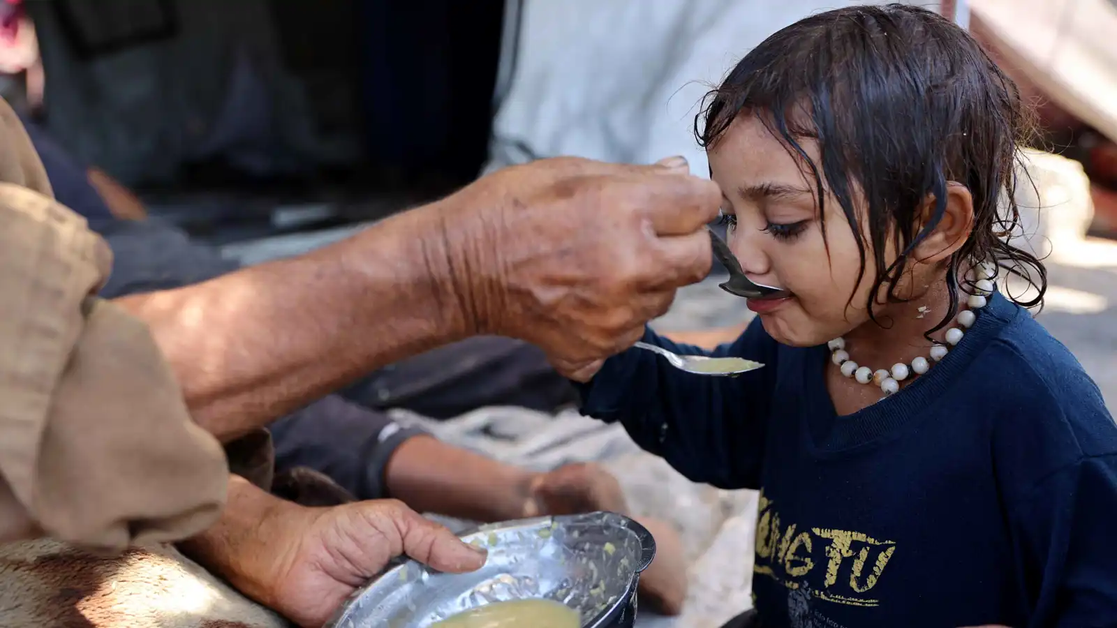 بعد تسجيل حالات وفاة في غزة.. ما متلازمة "غيلان باريه"؟