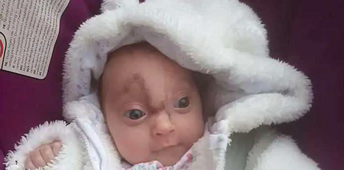 "المعجزة الصغيرة".. طفلة تخالف توقعات الأطباء بموتها خلال ساعات (صور)