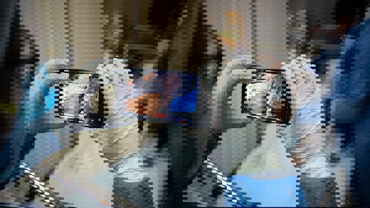 الصحة العالمية تستخدم "إم بوكس" اسمًا جديدًا لجدري القرود