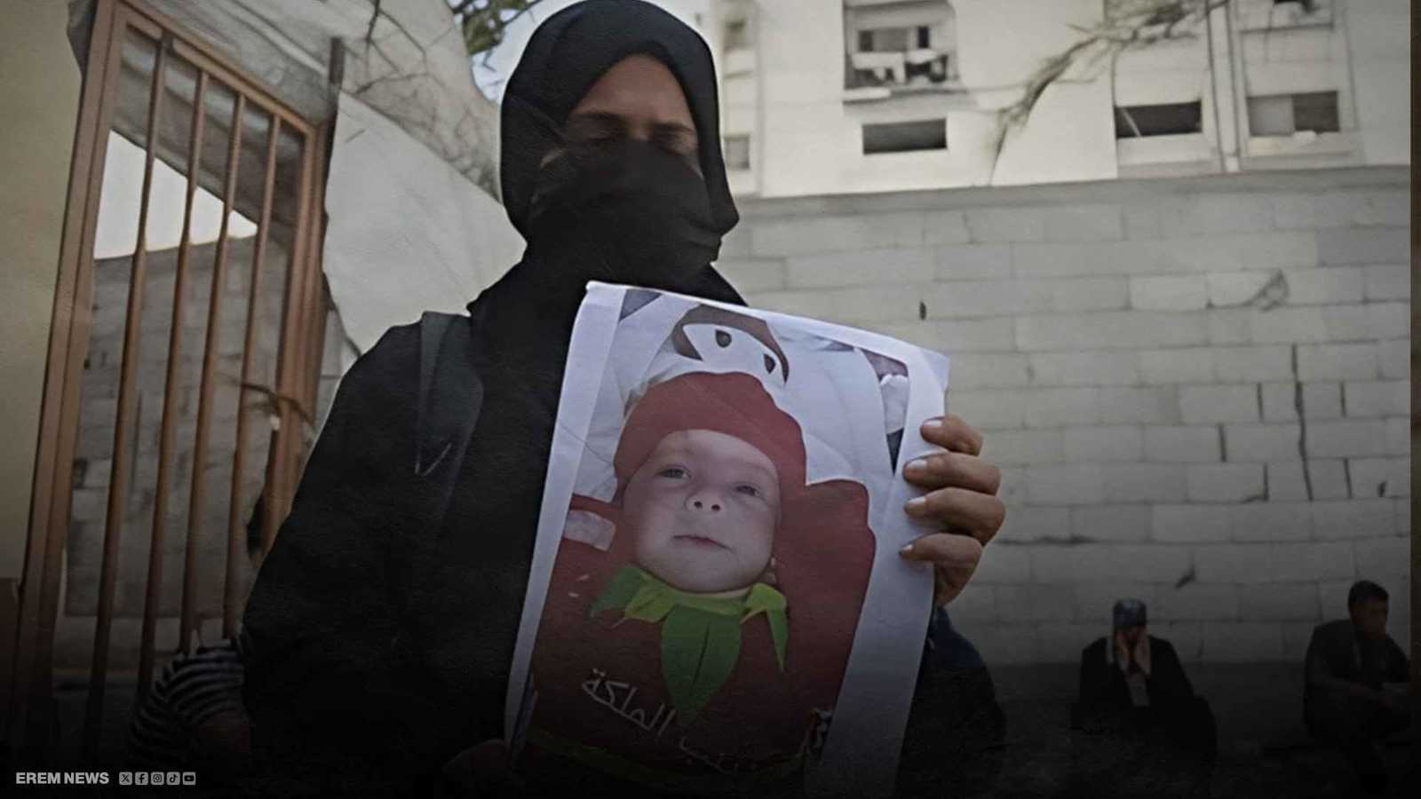 زينب.. طفلة ماتت جوعا ووزنها أقل من كفّ اليد