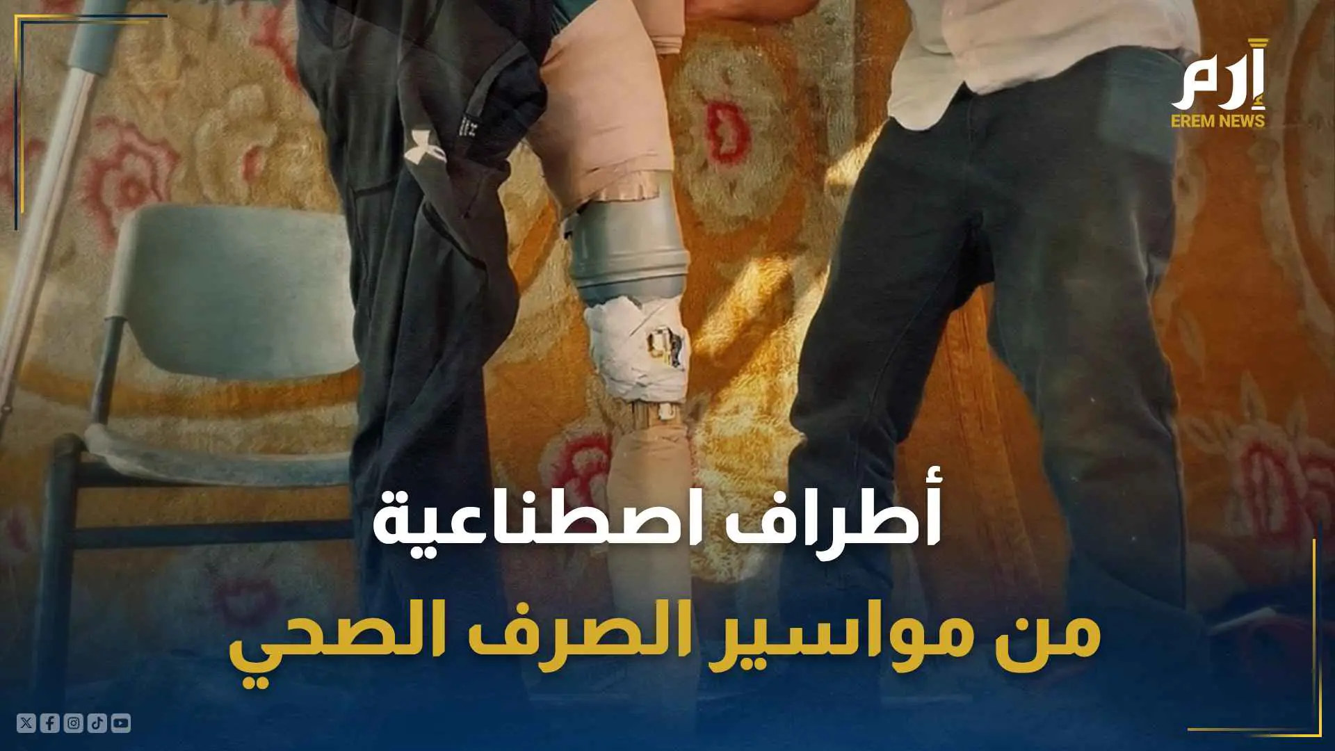 مصاب غزاوي يرتدي طرفا اصطناعيا