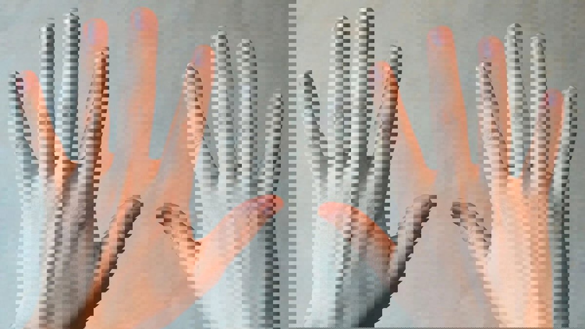 "جرس إنذار".. نتوءات الأظافر تنذر بمتاعب صحية

