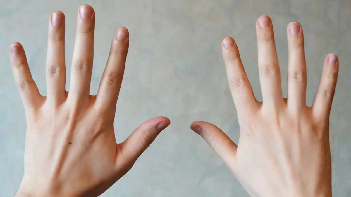 "جرس إنذار".. نتوءات الأظافر تنذر بمتاعب صحية

