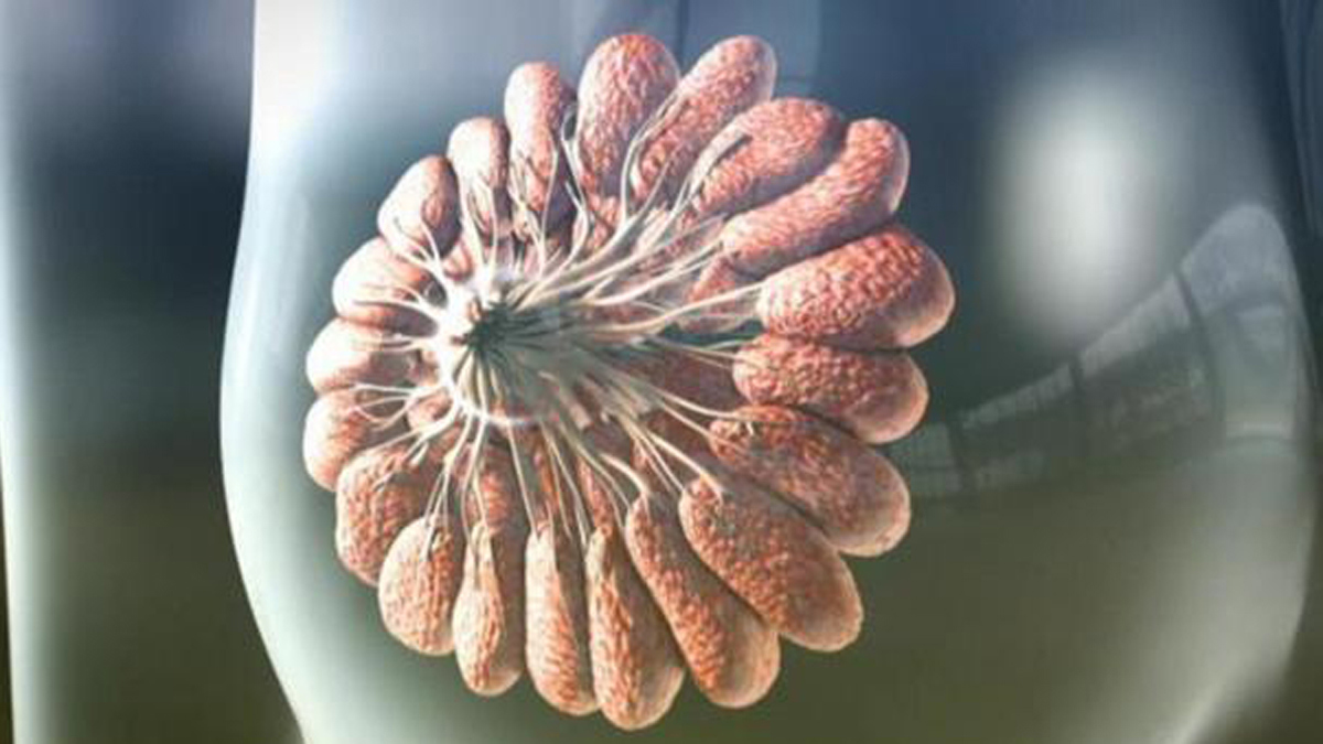 نظام ذكي من "غوغل" يتفوق على الأطباء في دقة تشخيص سرطان الثدي‎