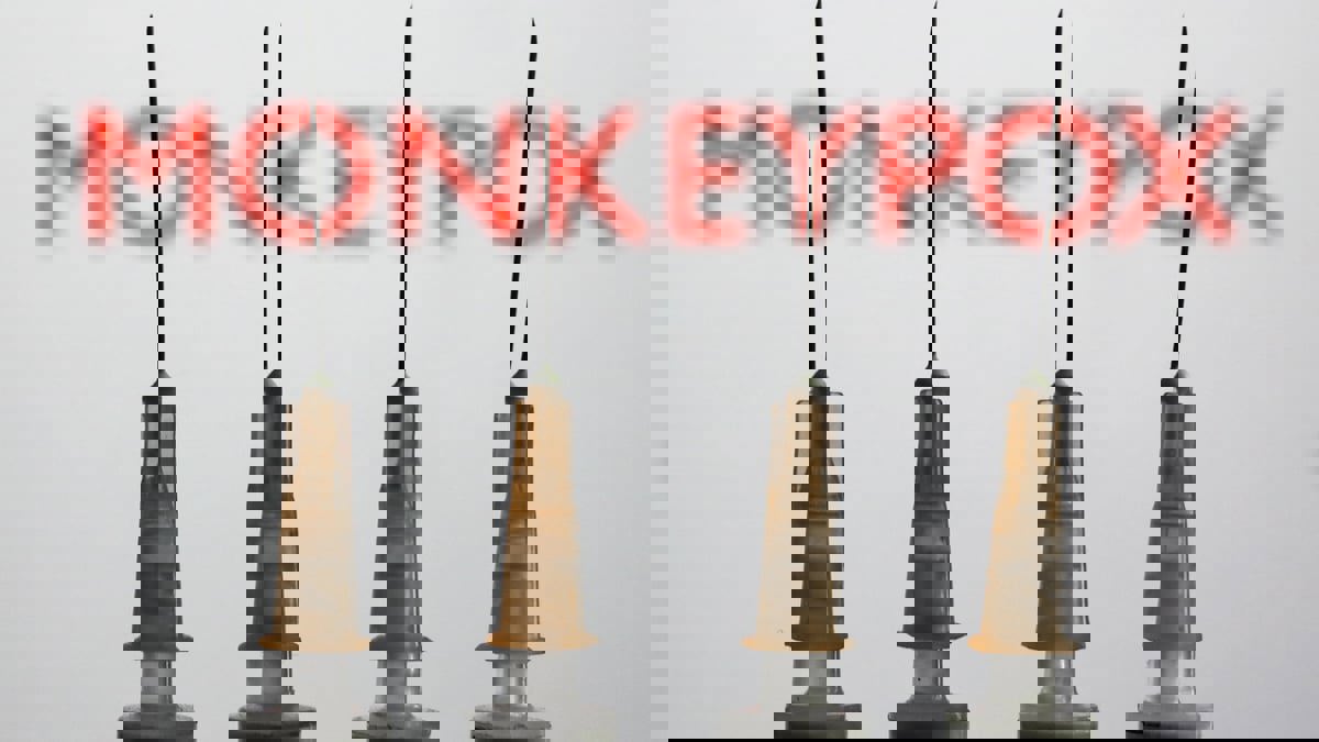 فاوتشي: جدري القرود سيستمر في الانتشار.. ويجب تلقيح المثليين أولا