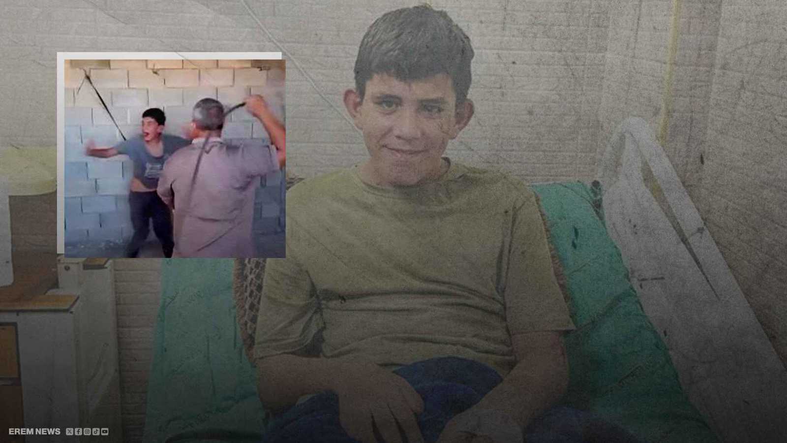 تعذيب مروع.. طفل فلسطيني من أصحاب الهمم ضحية الجلد بالحديد (فيديو)