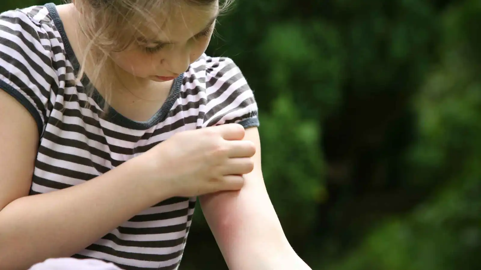 احذرها.. أمراض خطيرة قد تنقلها لدغات البعوض