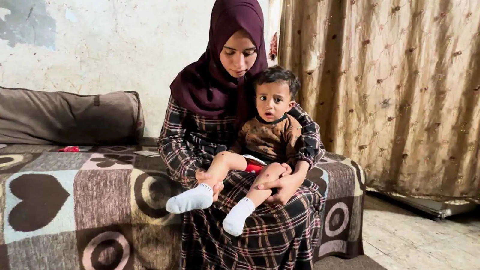 "جواد".. ندوب رضيع تفضح قسوة التعذيب الإسرائيلي