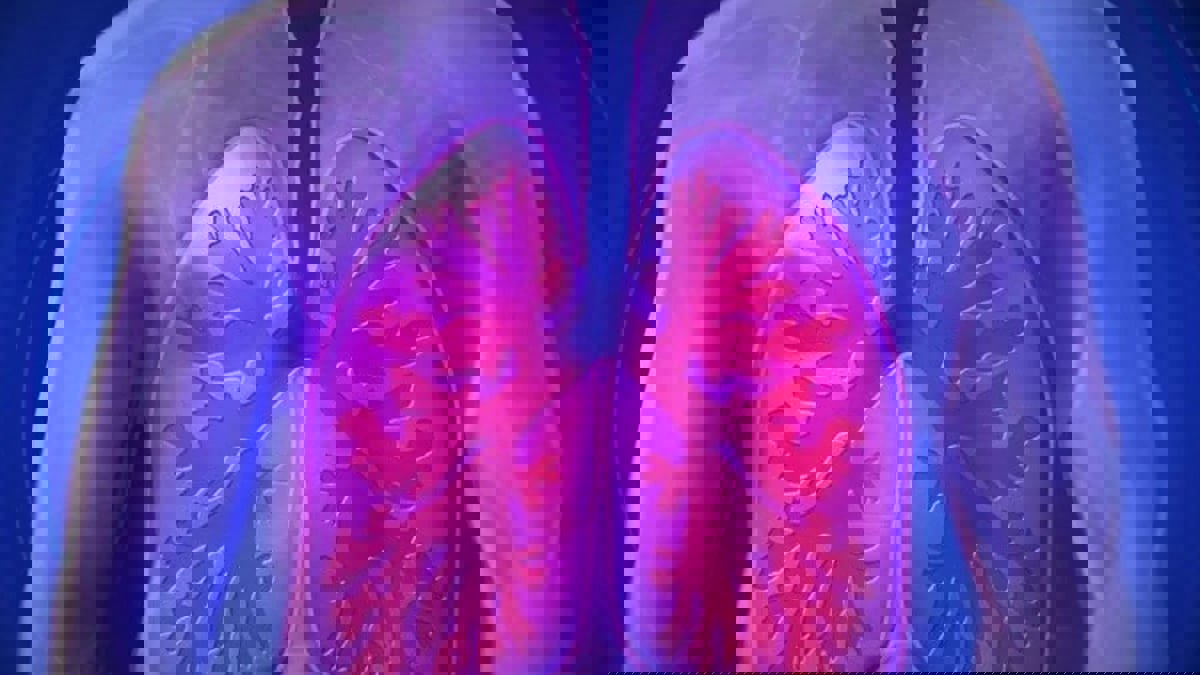 تطوير جهاز استشعار نانوي يميز بين الالتهاب الرئوي الفيروسي والجرثومي