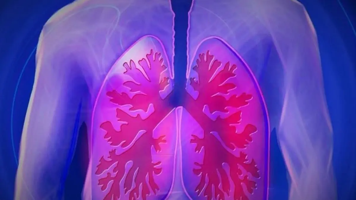 تطوير جهاز استشعار نانوي يميز بين الالتهاب الرئوي الفيروسي والجرثومي