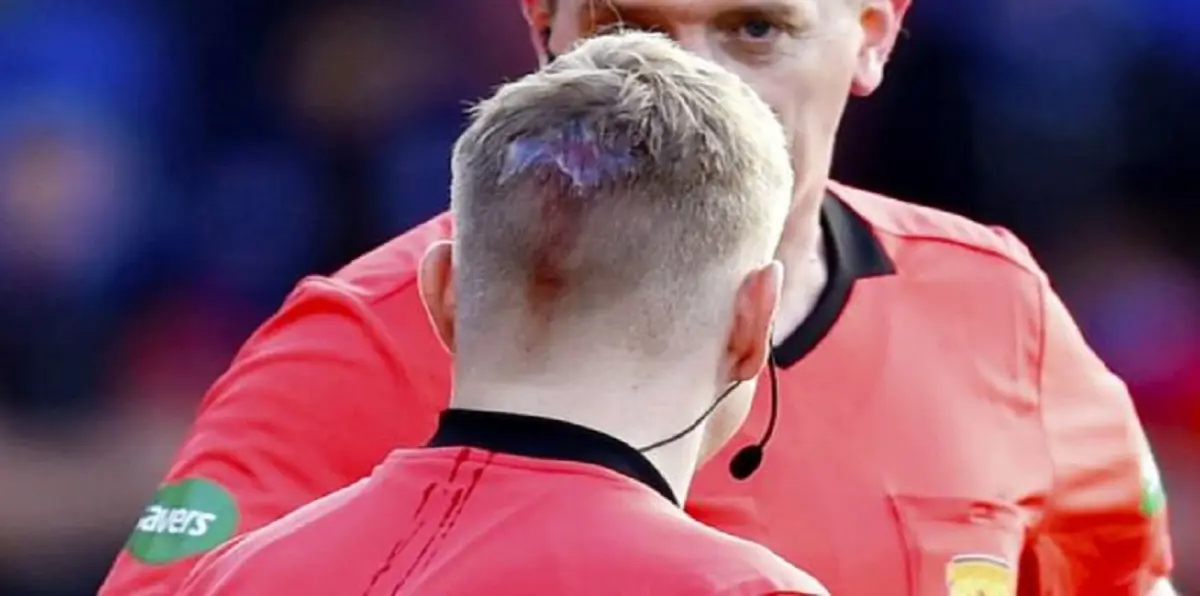 توقف مباراة رينجرز وليفنغستون في الدوري الإسكتلندي بعد إصابة مساعد الحكم بجرح في رأسه (فيديو وصور)