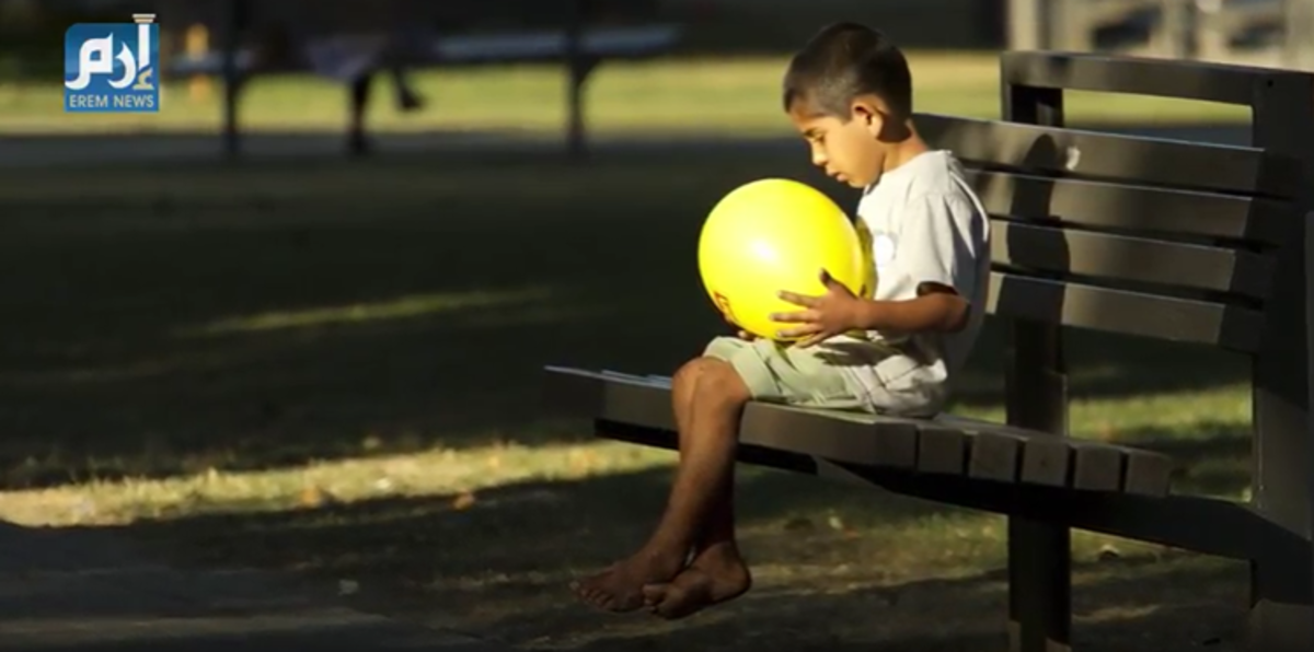 10 أطفال مصابون بحالات فريدة من نوعها (فيديو غرافيك)