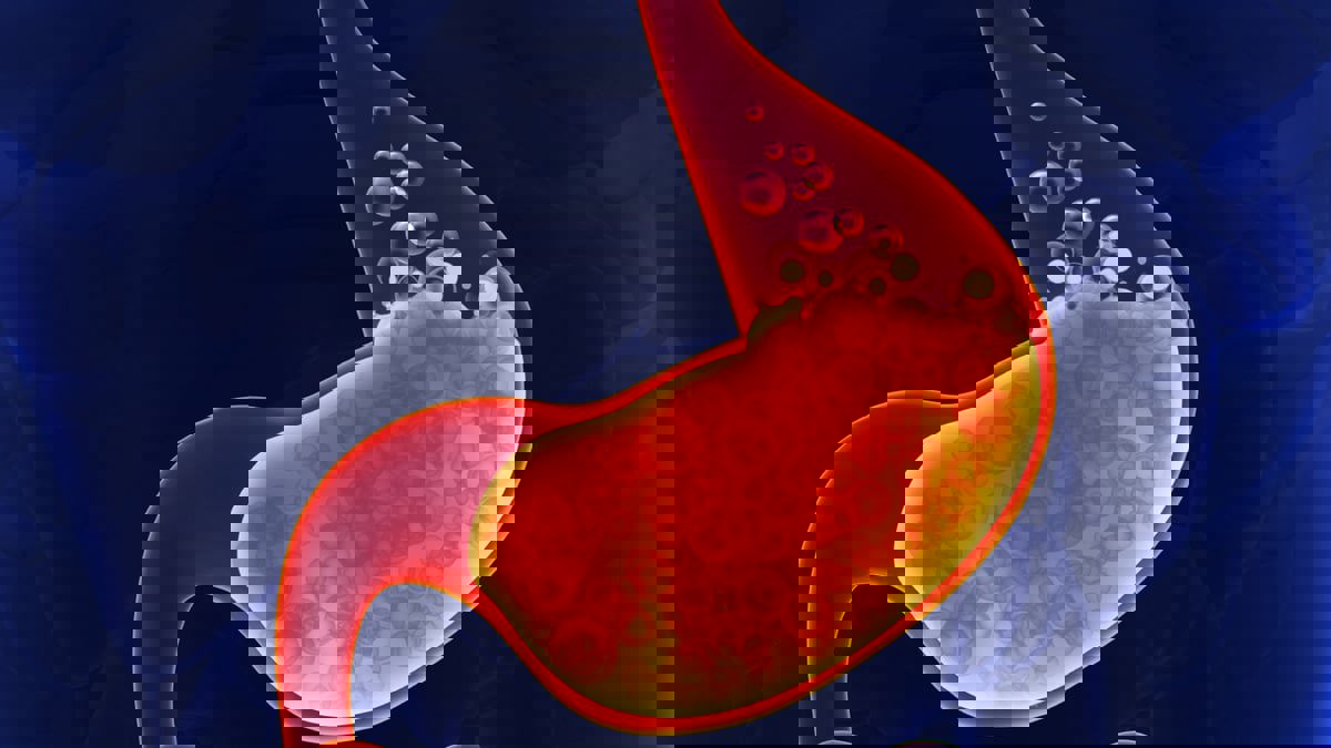 5 طرق بسيطة لتجنب حرقة المعدة