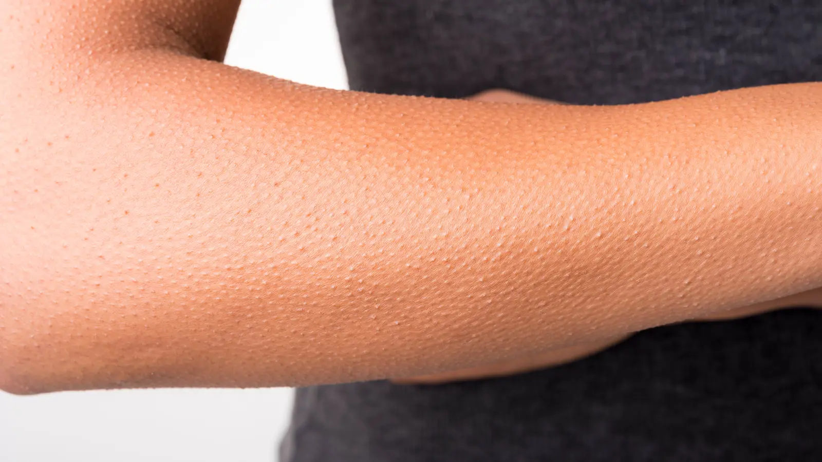 "القشعريرة".. استجابة طبيعية أم مؤشر على مشكلة صحية؟