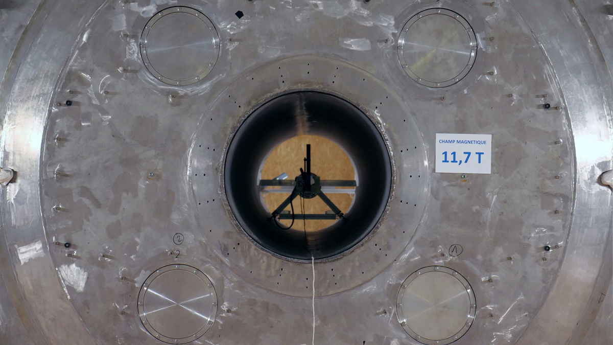 علماء يطورون جهاز أشعة ضخمًا يكشف أمراض الدماغ