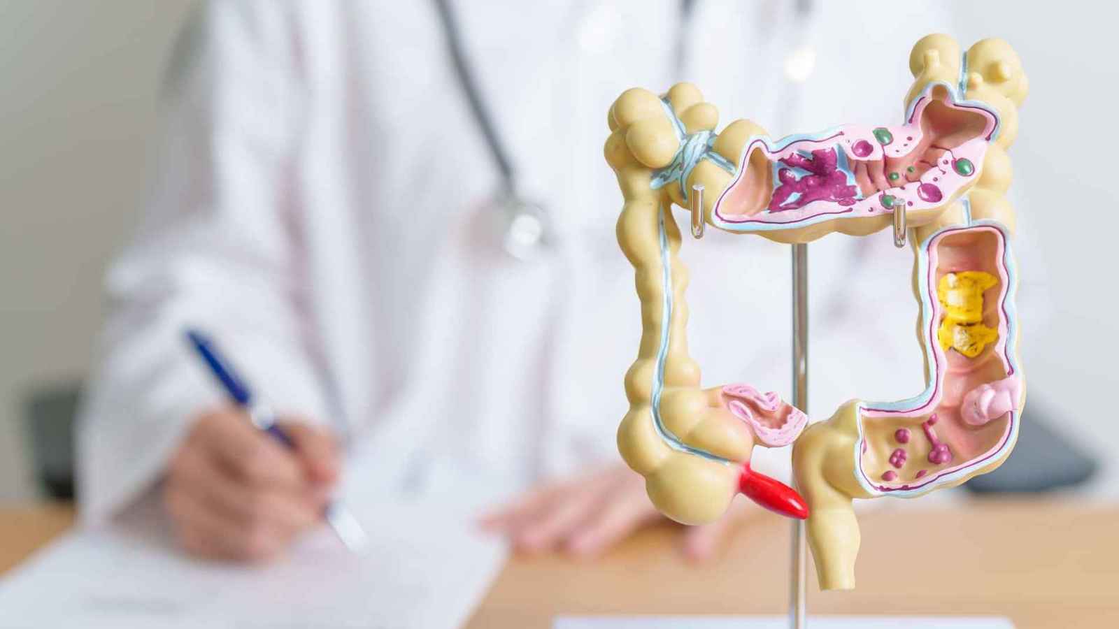 "العمر البيولوجي".. نافذة جديدة للكشف المبكر عن سرطان القولون