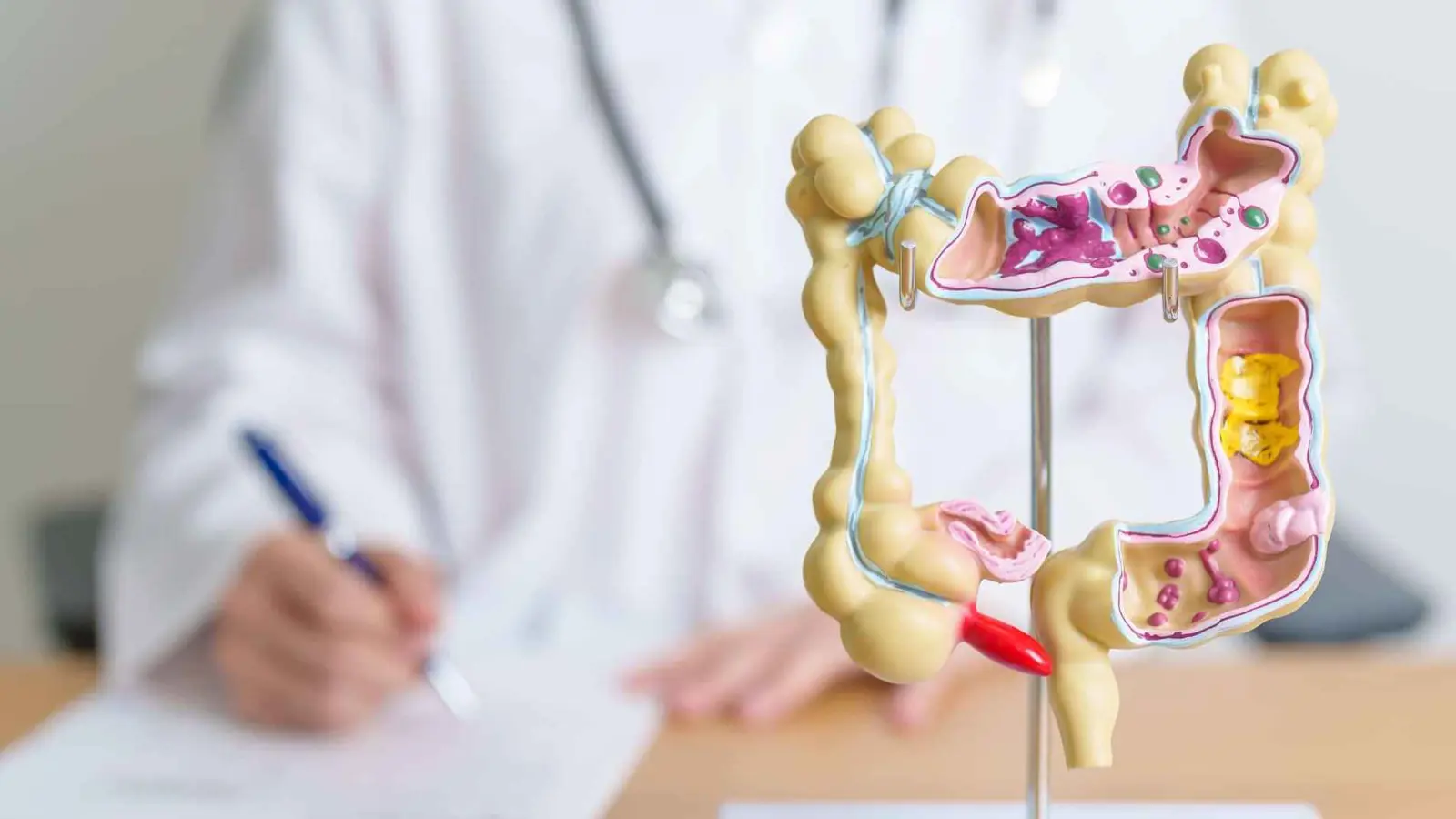 "العمر البيولوجي".. نافذة جديدة للكشف المبكر عن سرطان القولون