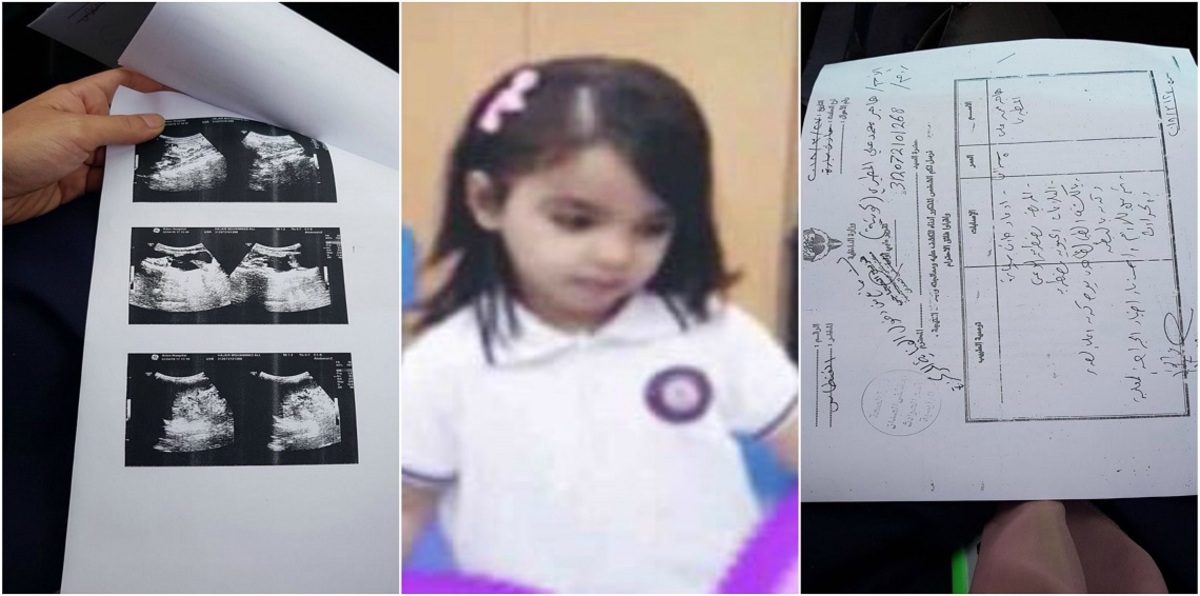 حادثة وفاة طفلة نتيجة خطأ طبي تشعل غضب الكويتيين