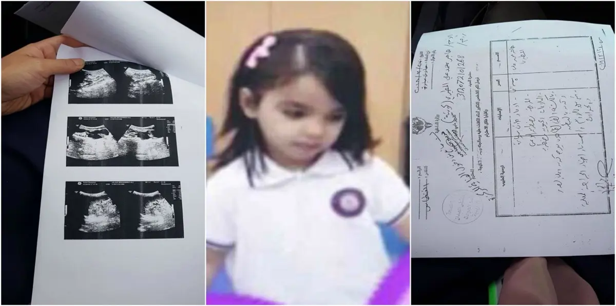 حادثة وفاة طفلة نتيجة خطأ طبي تشعل غضب الكويتيين