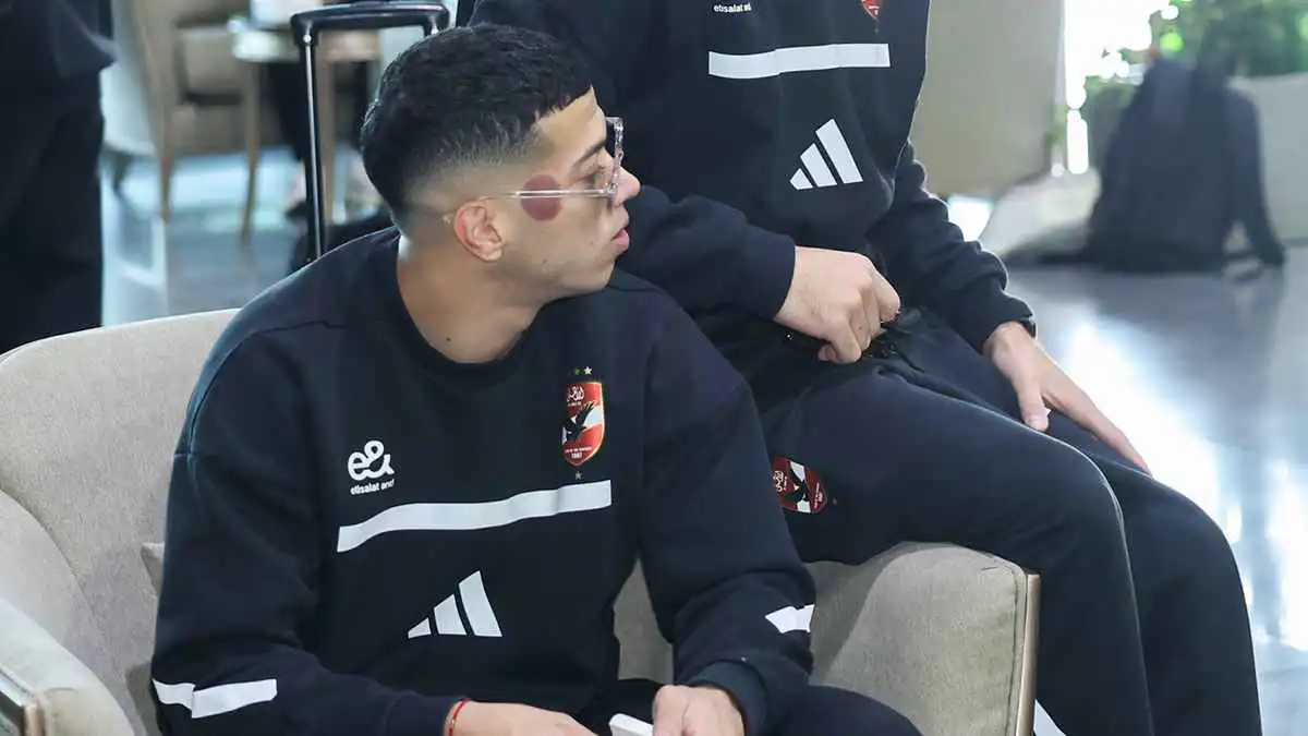 ما سر البقعة الحمراء التي ظهرت في وجه إمام عاشور؟ (صور)