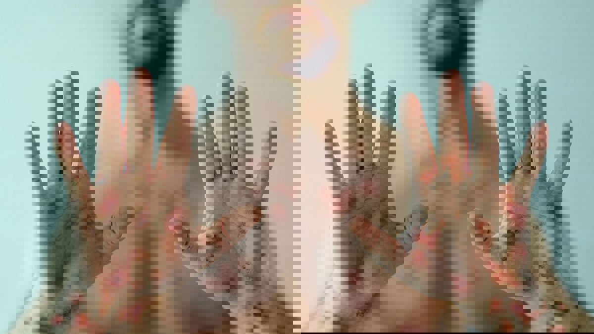 جدري القردة.. إلى أين؟