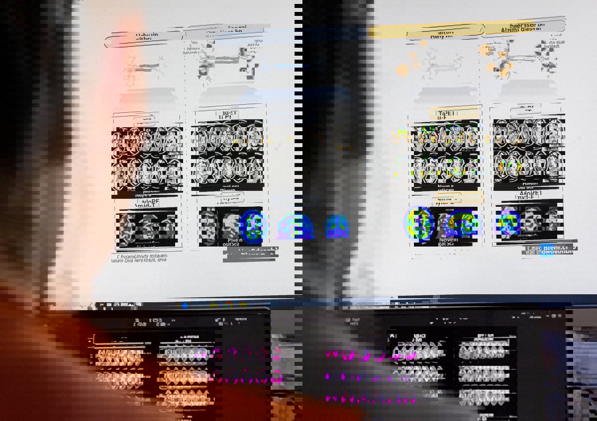 الجهاز العصبي.. "حيل صغيرة" تحل مشاكل صحية كبيرة 