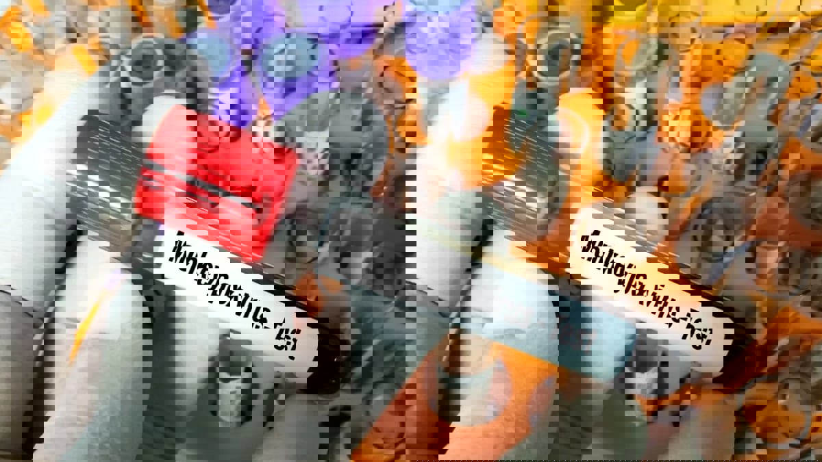 أمريكا تعلن "جدري القرود" حالة طوارئ صحية عامة