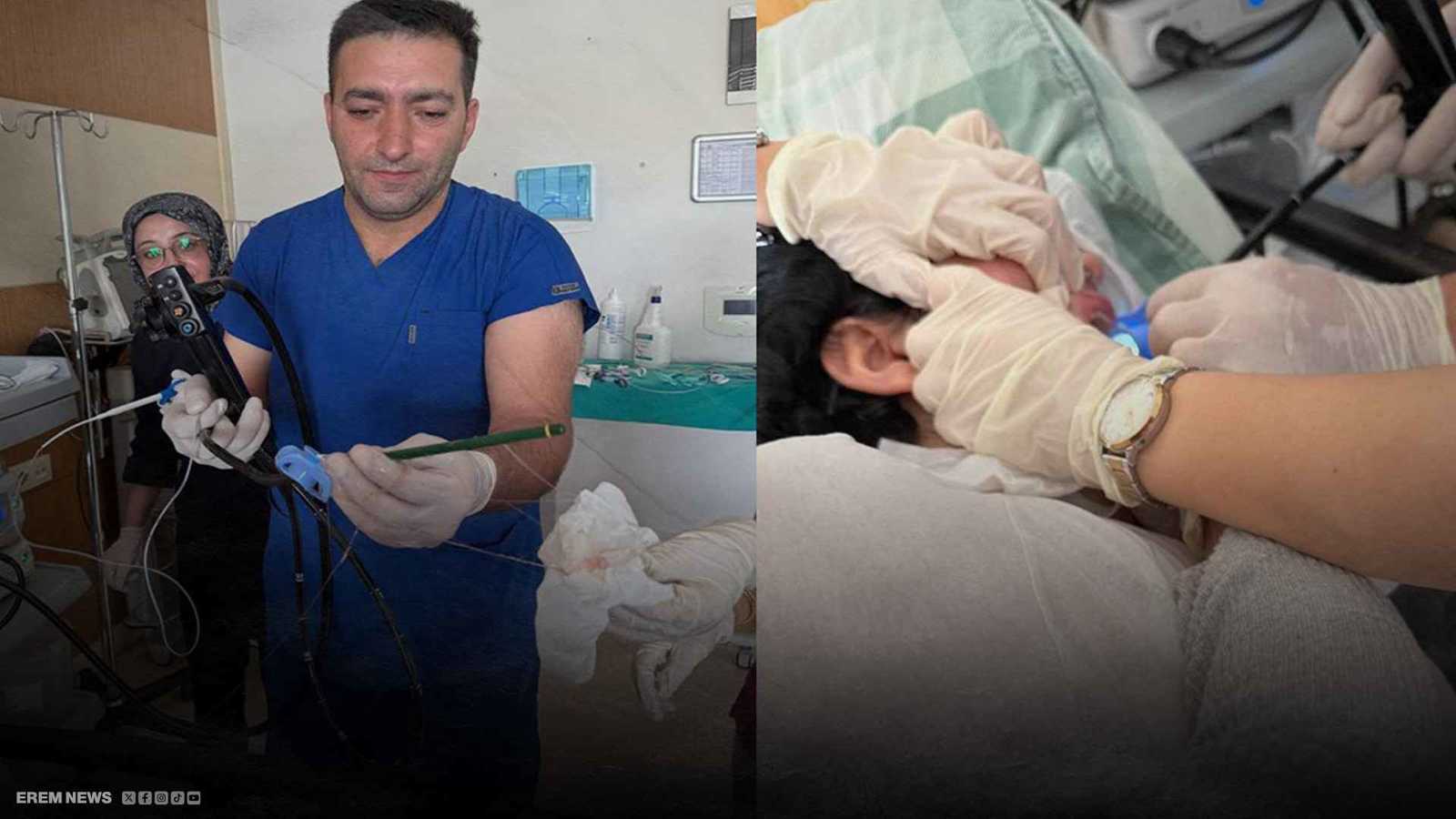 صدمة في مستشفى تركي.. استخراج قلمين من معدة مريضة