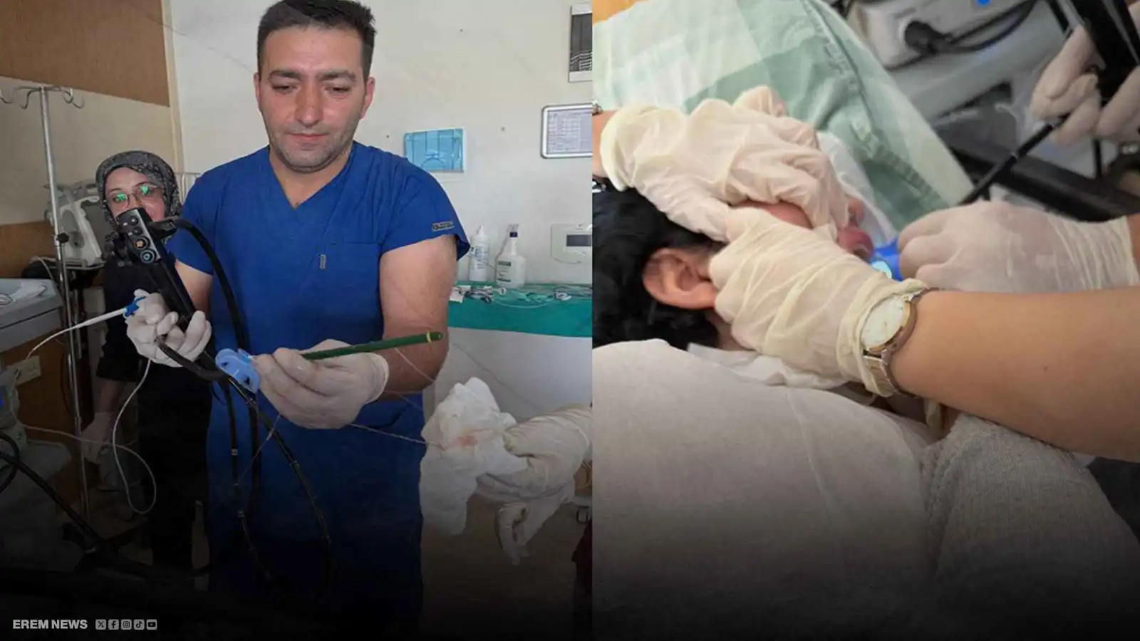 صدمة في مستشفى تركي.. استخراج قلمين من معدة مريضة