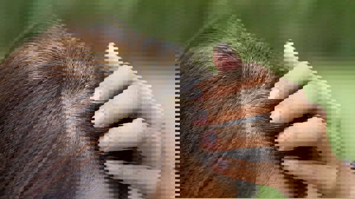 أطعمة تمنع ظهور الشيب في عمر مبكر